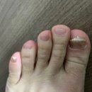 망포4층약국 | 발각질 무좀 케어 추천:: 문제성 손발톱 1:1 맞춤관리, 푸스케어 수원 영통점