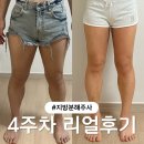(주)더라인 - 의정부시 | 분당 지방분해주사후기 리얼 후기 허벅지 라인 변화 효과 통증 정리