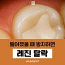 광장치과재료 이미지