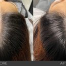 헤드샷스칼프본점 이미지