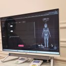 인제메디컬센터 | 서면 지방흡입 대신 쥬비스다이어트 체중후기