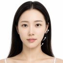 영등포 실리프팅 후기, 전후사진으로 보는 리프팅 효과