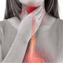 허리나은병원건강식품 | 역류성 식도염 완치 후기 — 3개월 만에 나은 방법