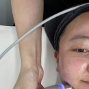 아쿠아플러스 남대구점 | [대구민감예민피부 라플러스에스떼] 작은얼굴 + 아쿠아필 물방울 리프팅 + 레이저까지✨