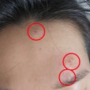 국홍일국정표피부과의원 이미지