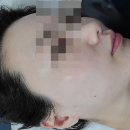 다니스킨 | 아차산역 피부 관리 다니스킨 물방울리프팅 만족후기