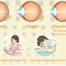 폴포이스안경 이미지