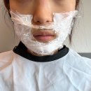 용산-400 | 용산피부과에서 슈링크유니버스 400샷 시술 통증, 리프팅효과 후기