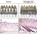 Korean scientists develop potential drug candidate for hair loss 이미지