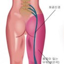 성산라파의원 네이버블로그