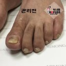 미몽 이미지