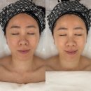 (주)서진개발 | 구로 신도림 피부관리 에스테틱 구로 신도림 웨딩케어 인트라슈티컬스 / 자극 없는 피부광 관리 리얼후기