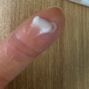 나을약국 | 여드름 연고 약국 추천템 종류 및 사용 후기