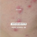 한솔피부관리