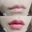 미인 한약국 | 생기있고 풍성한 아름다운 입술문신