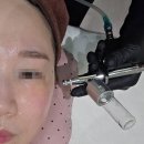 이브케어 | 청주피부관리 추천, 가경동피부관리 이브온 에스테틱 청주본점 산소리바이탈케어 후기
