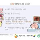 여수드림내과 네이버블로그
