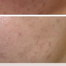 나니뷰티 이미지