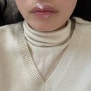 광주 반영구 립라인 오버립 립케어 만족스러운 후기 어울리 멜로우 더스무스