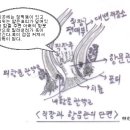 치질이 생기는 이유와 해결방법 이미지