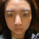 남동126 | 더트리니티스파 인천점 작은 얼굴 윤곽 관리 상세 후기