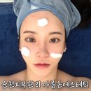 왕지3길 | 순천피부관리 아름온에스테틱 더쎄라 펜 줄기세포 스킨부스터 후기