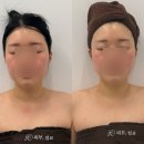 집중짱바둑교실(B) | 양산 피부,쉼표 윤곽관리 B코스 리얼 후기 비포에프터있음