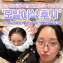 선송헤어 | 3탄] 여자 헤어라인 모발이식 1000모 수술 당일 후기 | 비절개 라인컷 + PRP 자가혈청 주사 (통증, 붓기...