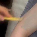 일곡도서관 | 광주 팔뚝 슬리밍 관리 리얼 후기 | 끌림뷰티앤바디