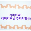 미아삼거리역 피부관리:기미치료! 레이저토닝 주의사항은? 이미지