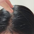 DDR | 리보리젠 2dDR 워터 스칼프 토닉 매일1분 셀프 두피케어 루틴 실천후기