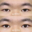 디비성형외과의원 이미지