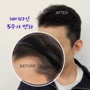 채우림뷰티 이미지