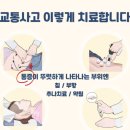 사랑한의원 | [장곡동] 교통사고 사랑한의원 내돈내산 후기