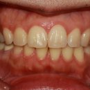 유어스치과병원 | 양산치과 치아미백 내돈 내산 찐후기