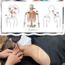 "두통, 목통증부터 측만증까지..." "모든 어깨 질환의 대장, 'Upper Trapezius' 실전테크닉" 이미지