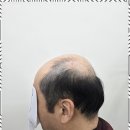 모앤도트 네이버블로그