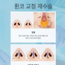 윌성형외과