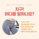 유로진남성의원 | 다이어트해도 안 빠지는 Y존돌출 해결 방법은 없을까요?