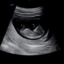 각도법 성별 알수있을까요 이미지