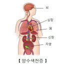 양수 색전증Amniotic fluid embolism여성질환 이미지