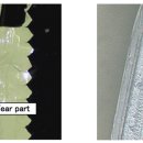 제7장 Peel seal과 tear seal의 식별 방법 - 1(파대의 발생 원인인 폴리옥의 해석) 이미지