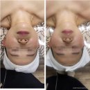 스파&힐링테라피