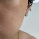 하나엠케어 | 수분크림 추천, 미백·탄력·보습까지 챙긴 아이엠케어 수분크림 사용 후기