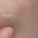 예젤의원 이미지