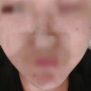 다빈레이저