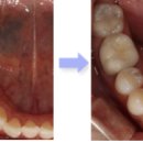 이화치과기공소 이미지