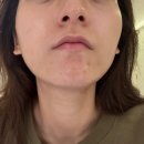 수원-1811 | 수원영통피부관리 유에스파 에스테틱 트러블관리 후기