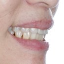 엠웍스 치과기공소 이미지