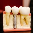 이(e)-밝은치과의원 이미지